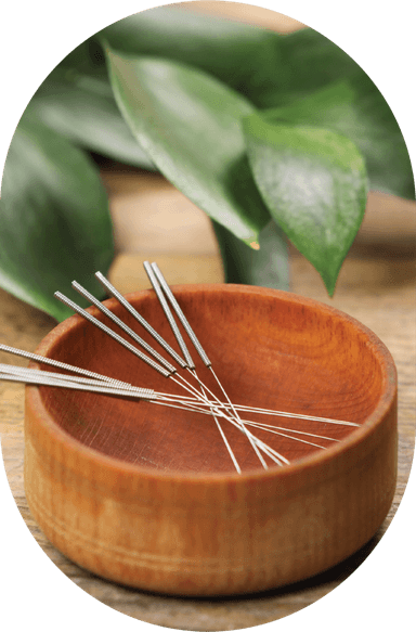 Acupuncture